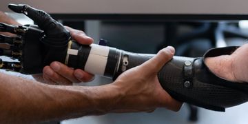 До Дія.City зможуть долучитися виробники біонічних протезів: Уряд ухвалив постанову